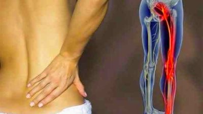 «الحرمل» لعلاج «عرق النسا»