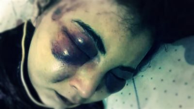 عذب زوجته بوحشية بسبب «فيس بوك»