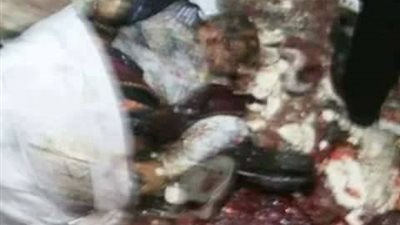 وزير العدل يكلف فريقا من الأطباء الشرعيين بالتوجه إلى طنطا 