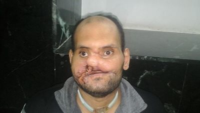 استغاثة للرئيس السيسي..نداء عاجل لوزير الصحة.. إهمال بمستشفي الإسكندرية يتسبب في إصابة «رمضان» بجلطة