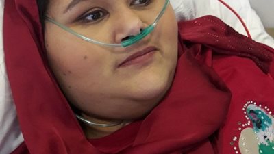 شاهد.. لأول مرة ظهور ملامح وجه أسمن امراة في العالم