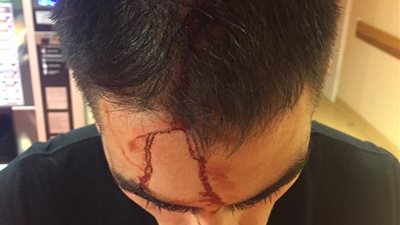  شاب مصرى يلقن «اسرائيلى» علقة ساخنة بسبب فلسطين 